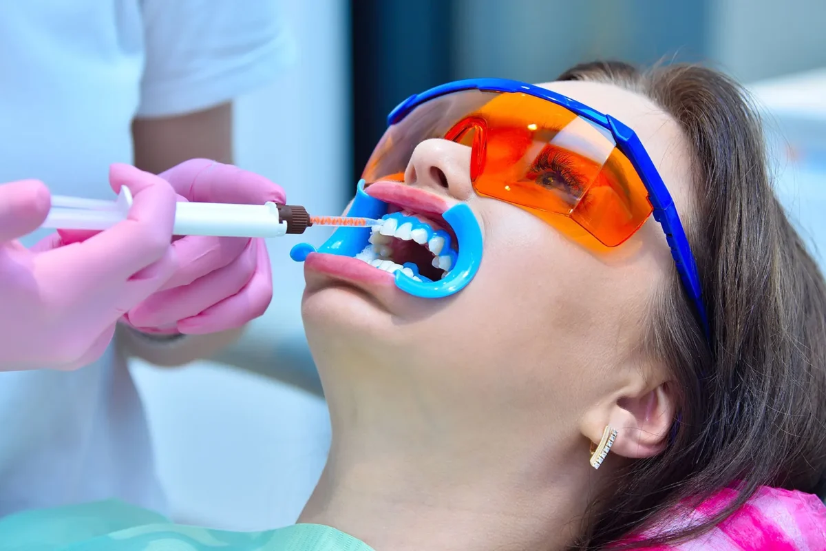 dental-img18