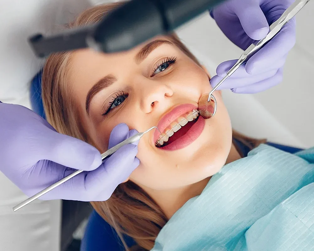 dental-img21