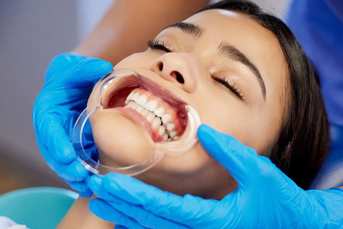 dental-img9